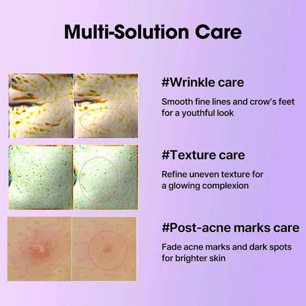 Carousel Main Image 4