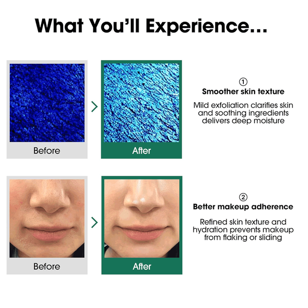 Carousel Main Image 4